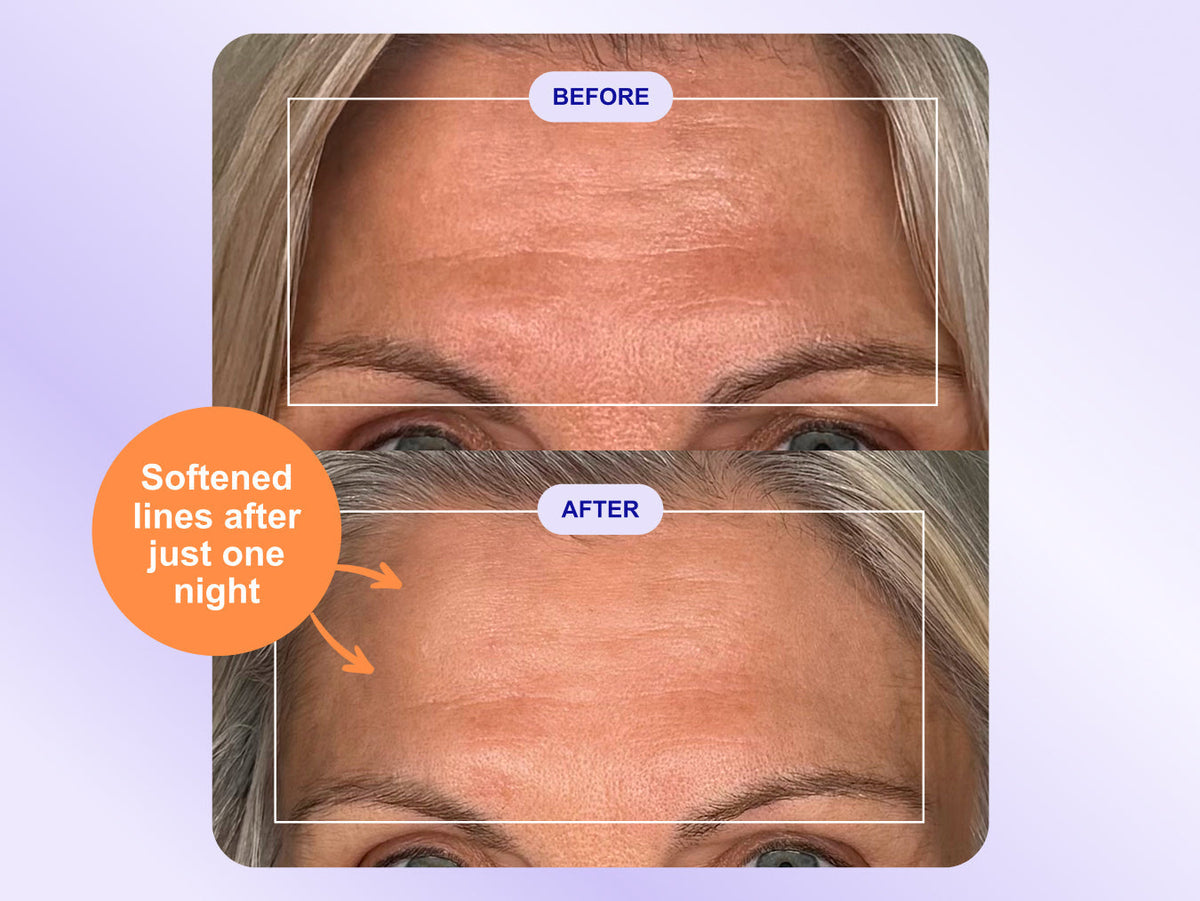 Wrinkles Schminkles blog banner on using wrinkle patches to prep skin before an event