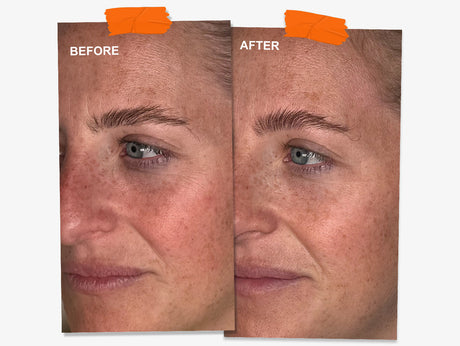 Wrinkles Schminkles blog banner on overnight wrinkle patch results in your 30s