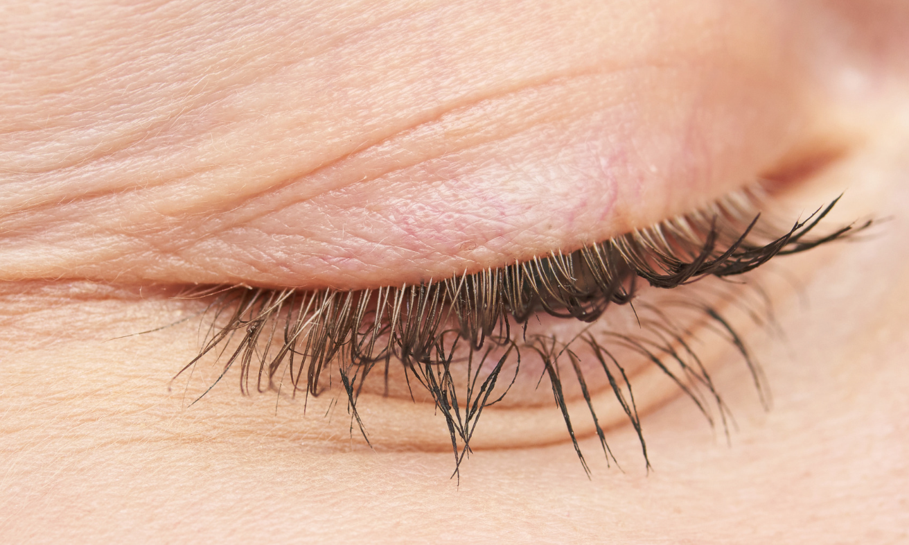 aesthetic treatments? Dysport? The Natural Approach? Confused as f***?! Let’s break it down.