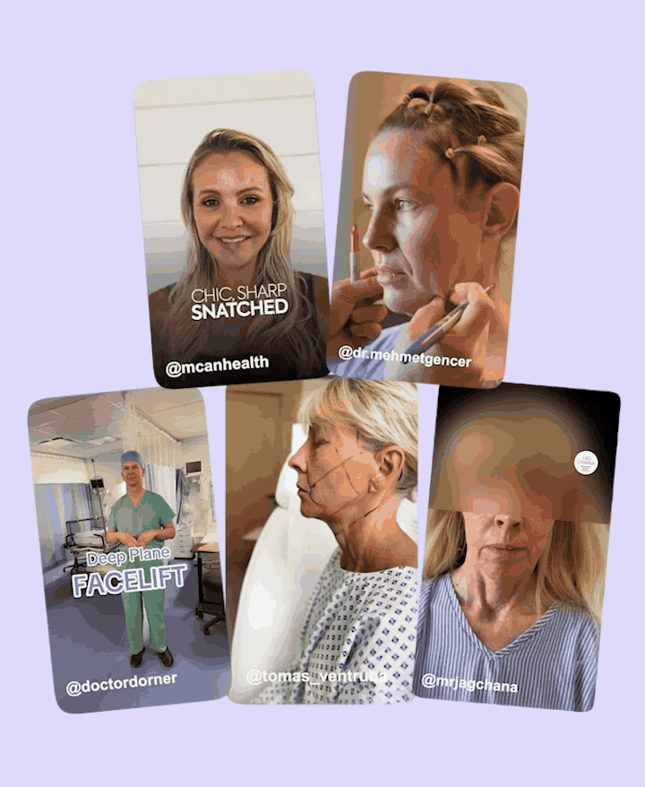 Wrinkles Schminkles blog banner on a non-surgical alternative to a facelift