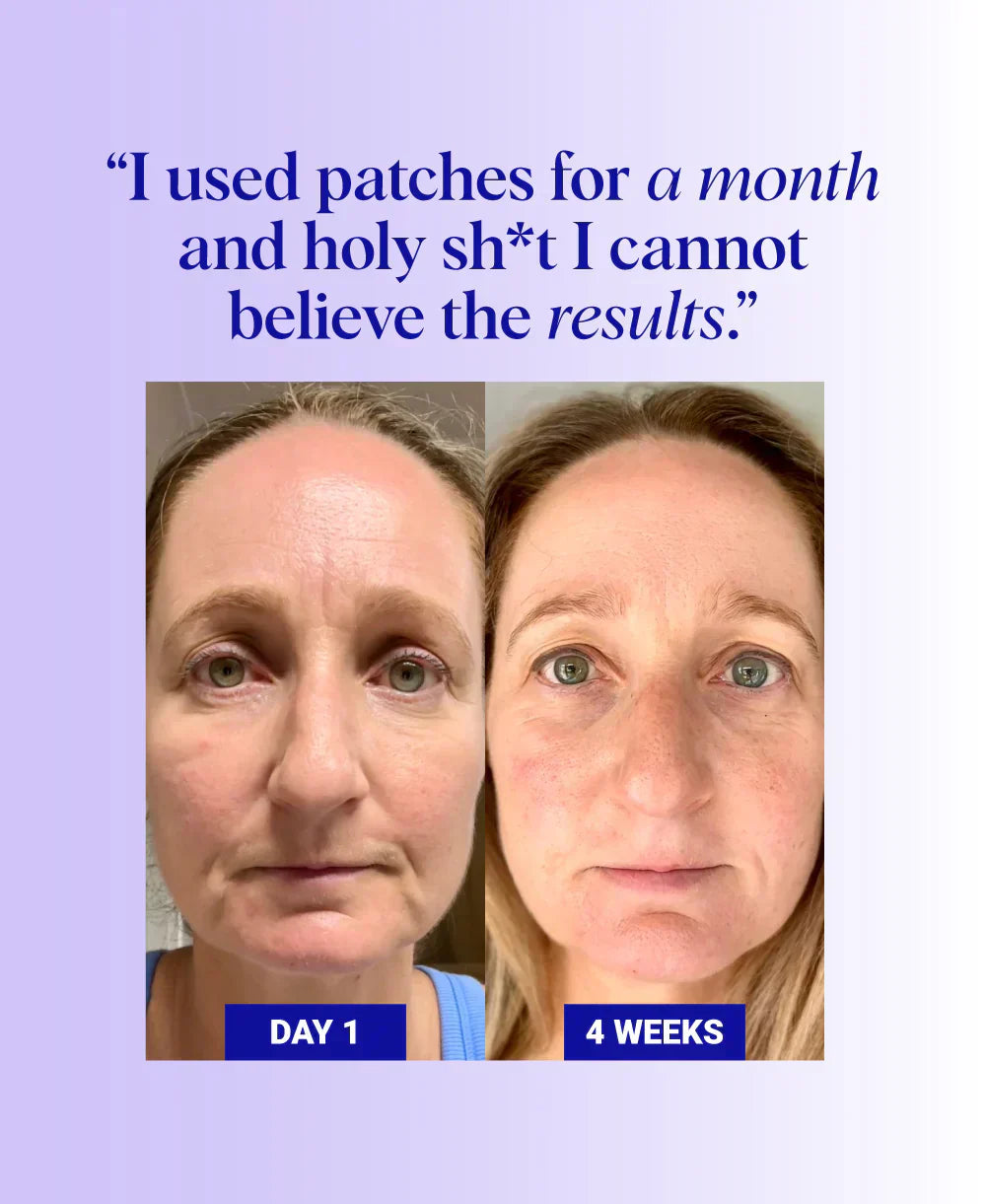 Do Silicone Patches Work? Here's One Woman's Incredible 4-Week Skin Transformation with Consistent Patching