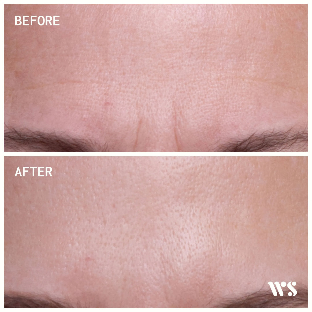 Forehead Product Test