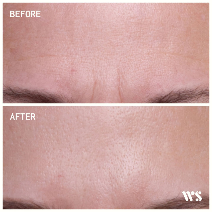 Forehead Product Test