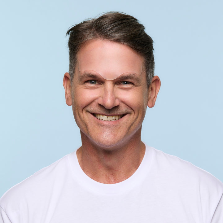 Men's forehead wrinkle patch applied to smooth forehead lines