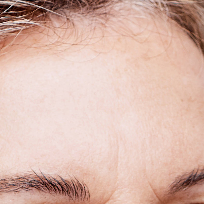 Silicone_Forehead_Patches_for_Wrinkles_and_Fine_Lines