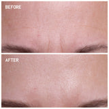 Wrinkles Schminkles Forehead Wrinkles | Trial Patch packaging