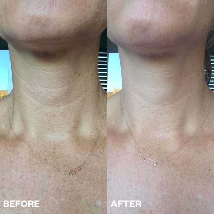 3 Step Neck Renewal Pack