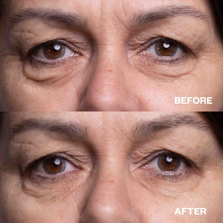 Bright Eye Duo