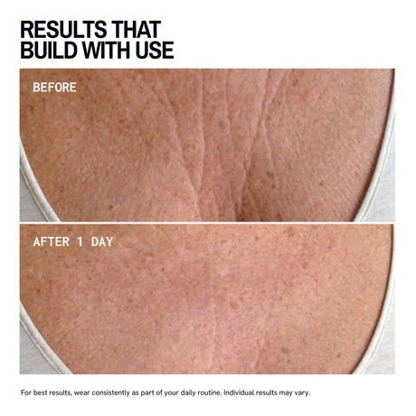 Chest Wrinkle Patches