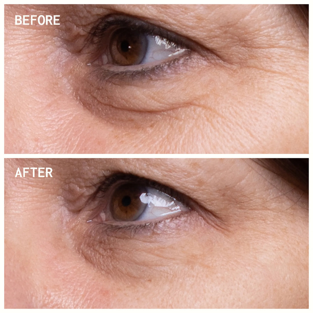Eye Wrinkle Patches