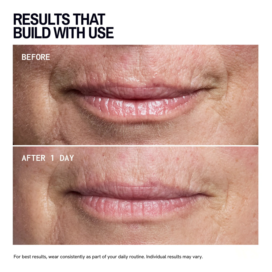 Mouth & Lip Wrinkles | Trial Patch