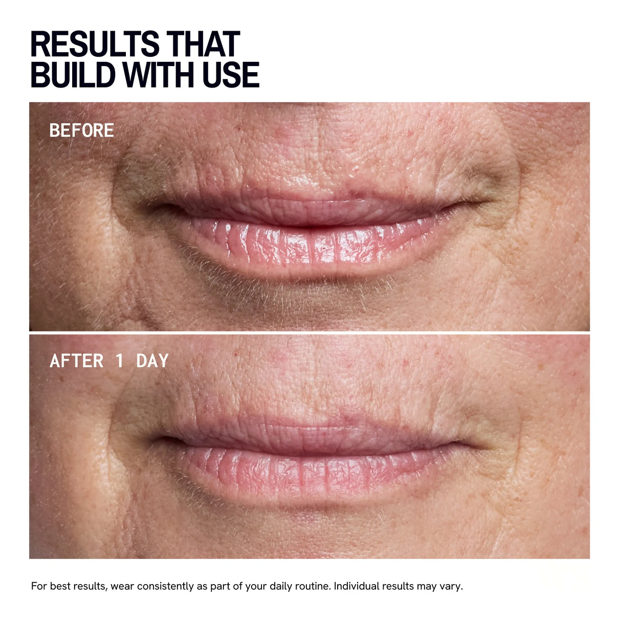 Mouth & Lip Wrinkle Patches