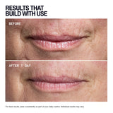 Mouth & Lip Wrinkle Patches