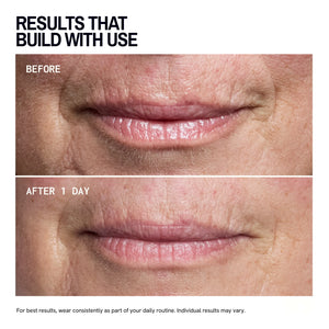 Mouth & Lip Wrinkle Patches
