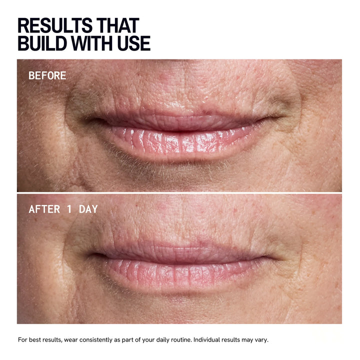 Mouth & Lip Wrinkles | Trial Patch