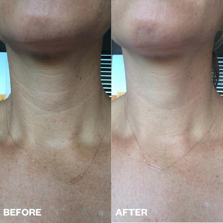 ws_neck_results