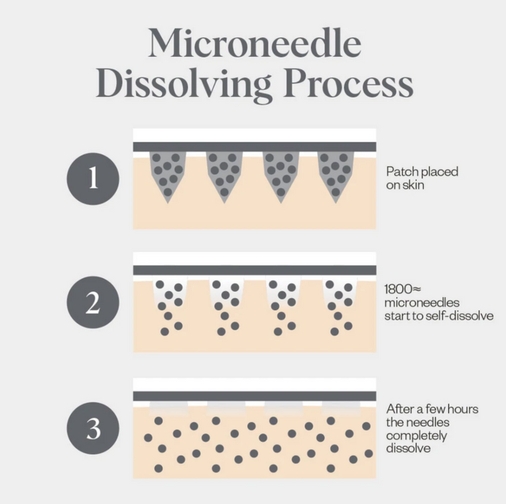 microneedle_process